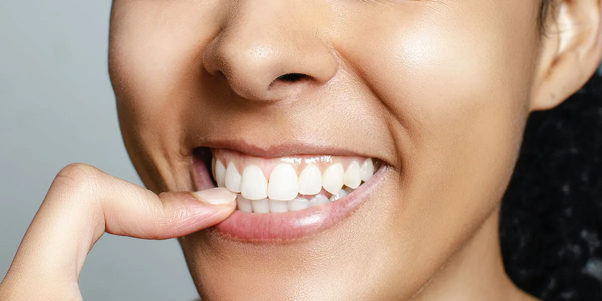 26902 teeth sensitivity whitening