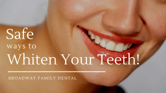 26903 teeth whitening overview