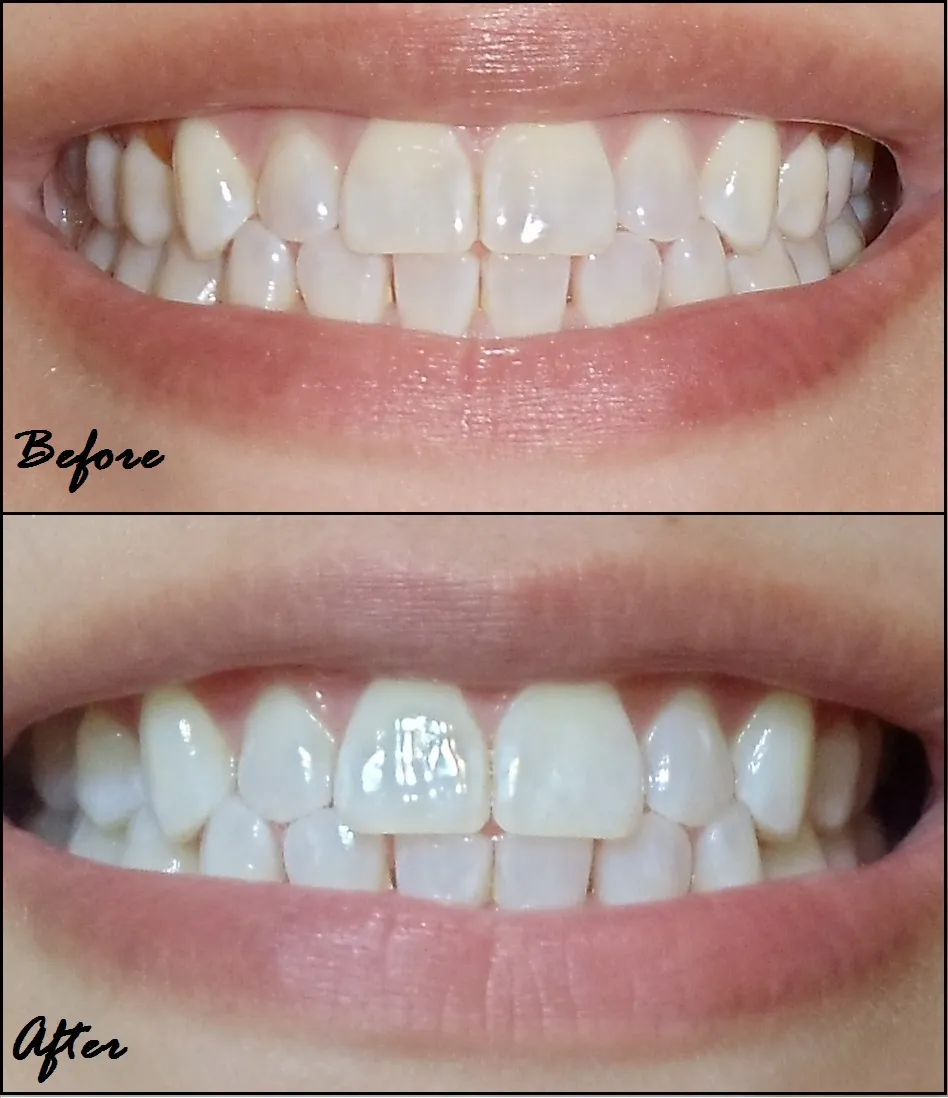 /img/26905-dentist-checkup.webp