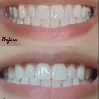/img/26905-dentist-checkup.webp