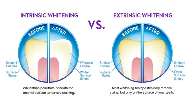 26905 science of teeth whitening