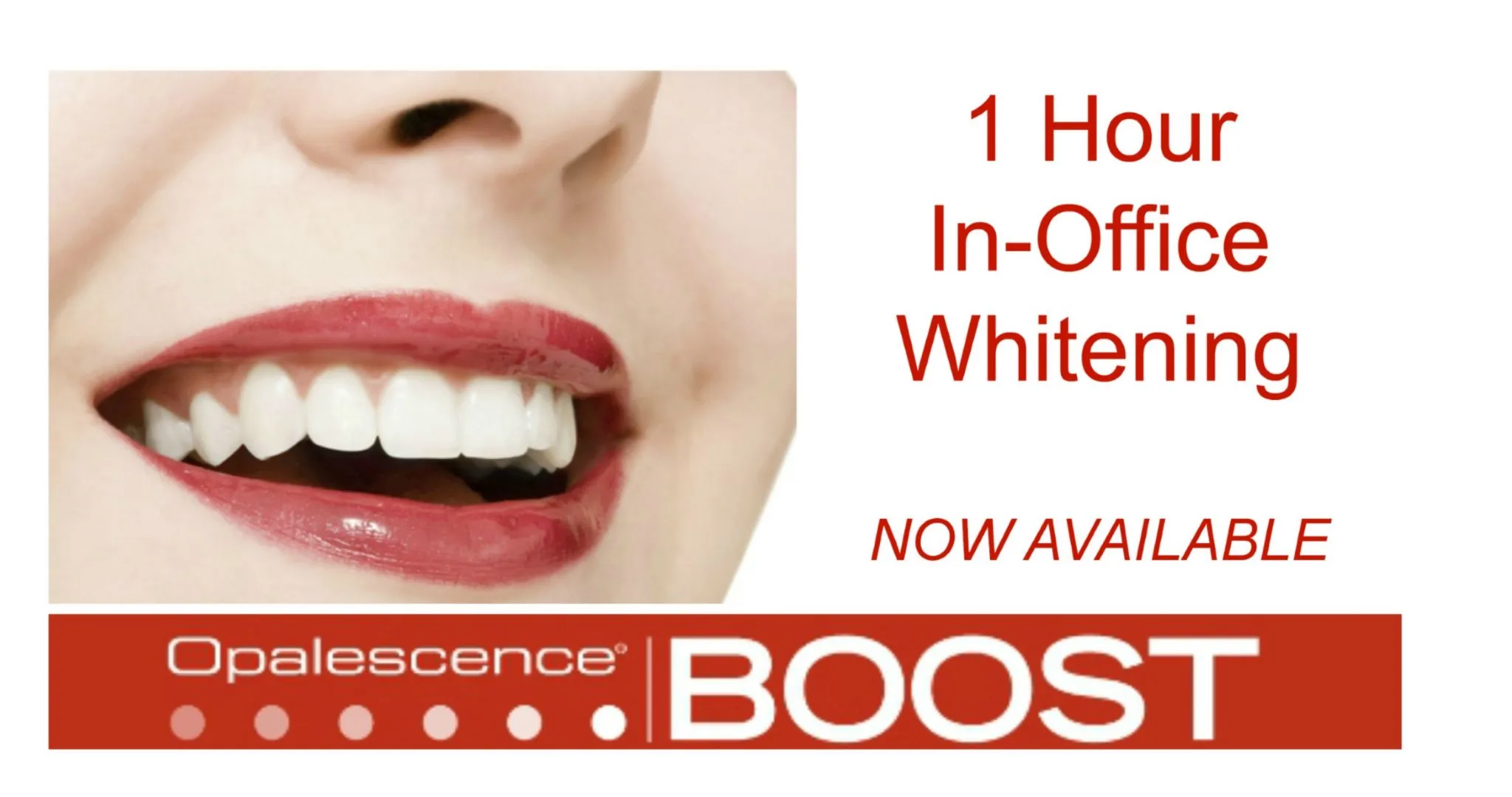 26906 teeth whitening sensitivity