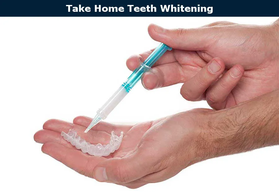 26911 burbank teeth whitening 3