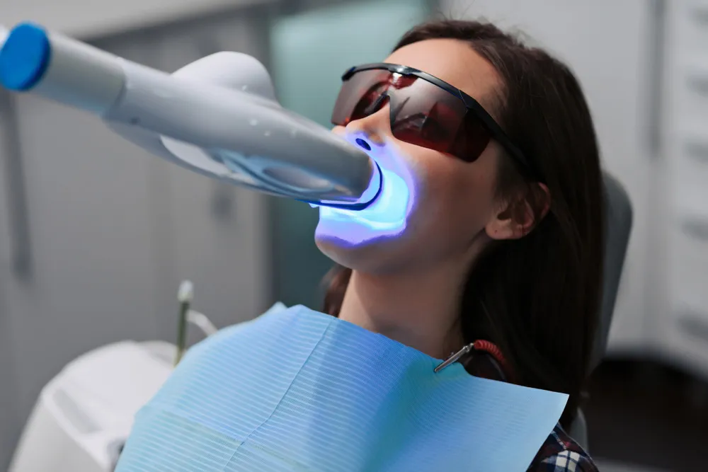 26912 teeth whitening warrington smile