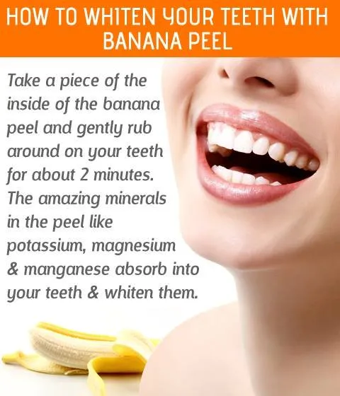 26913 teeth whitening hacks image6