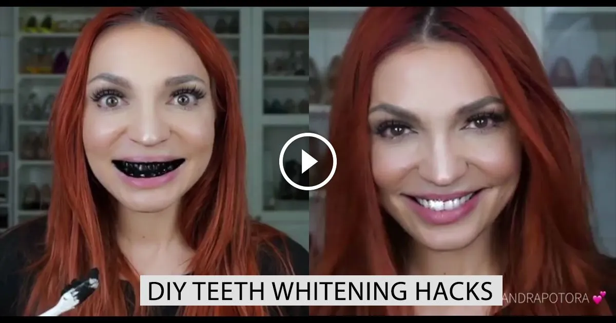 /img/26913-teeth-whitening-hacks-image7.webp