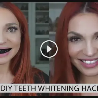 /img/26913-teeth-whitening-hacks-image7.webp