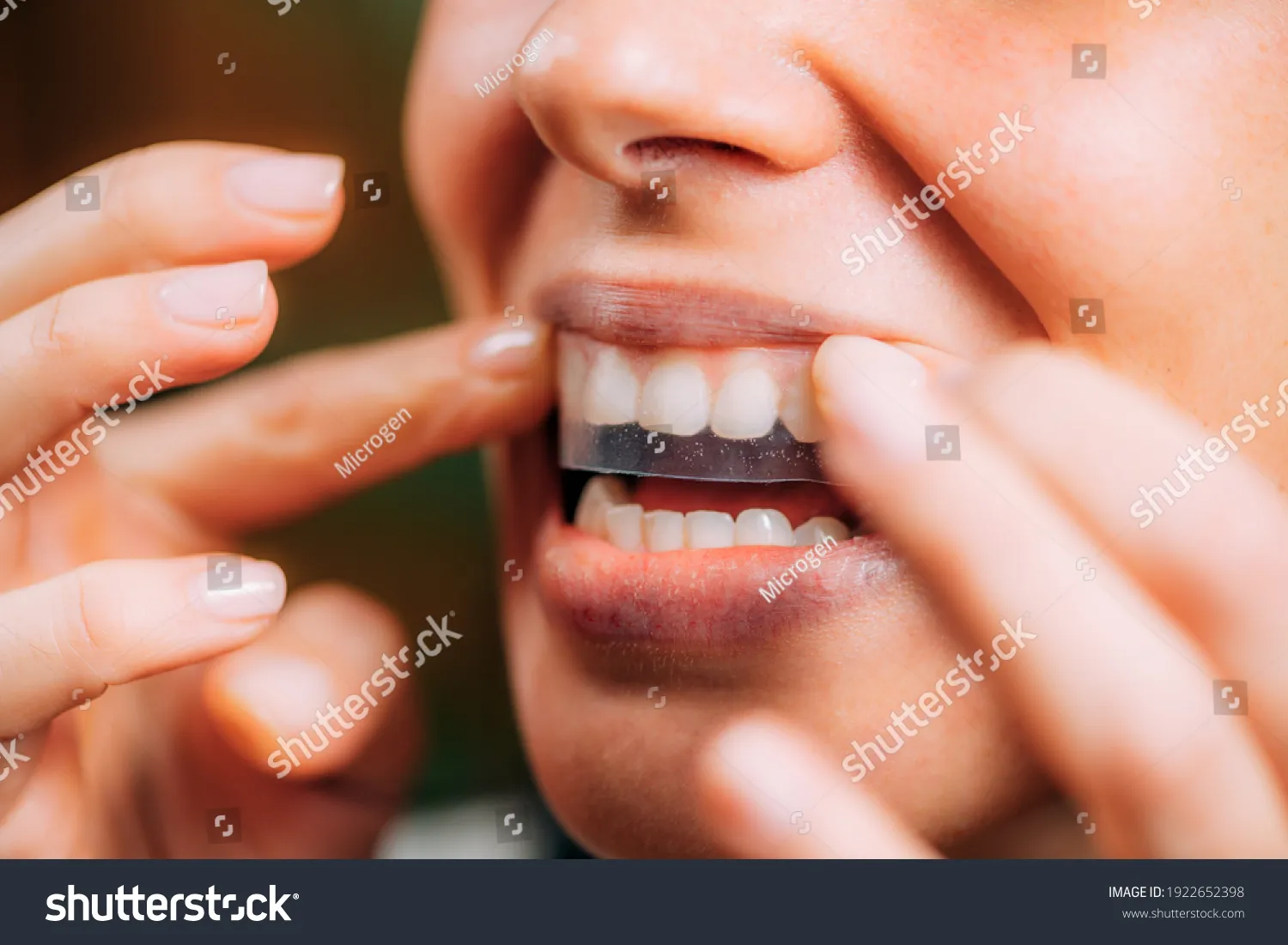 26922 teeth sensitivity