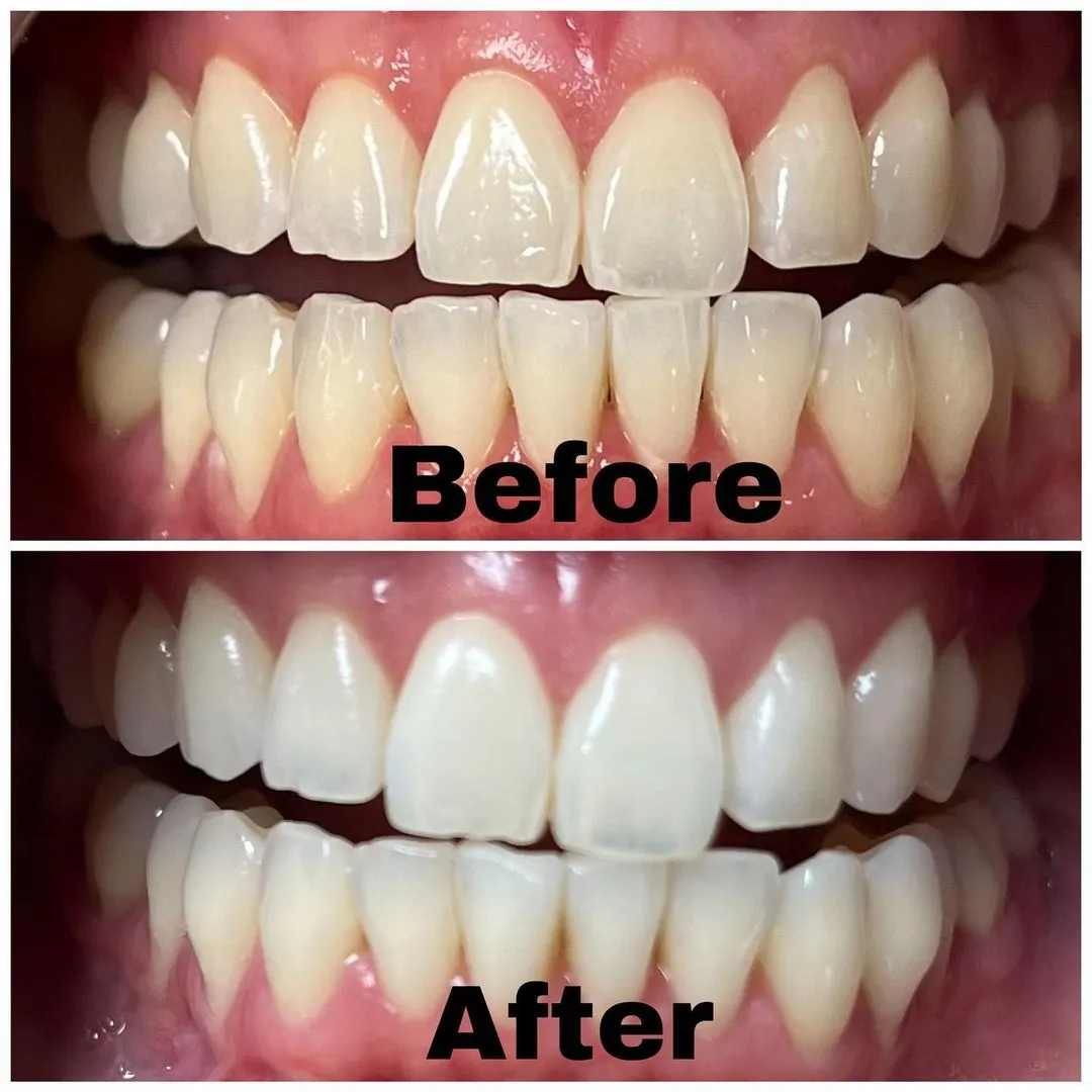 26923 avoid staining foods drinks