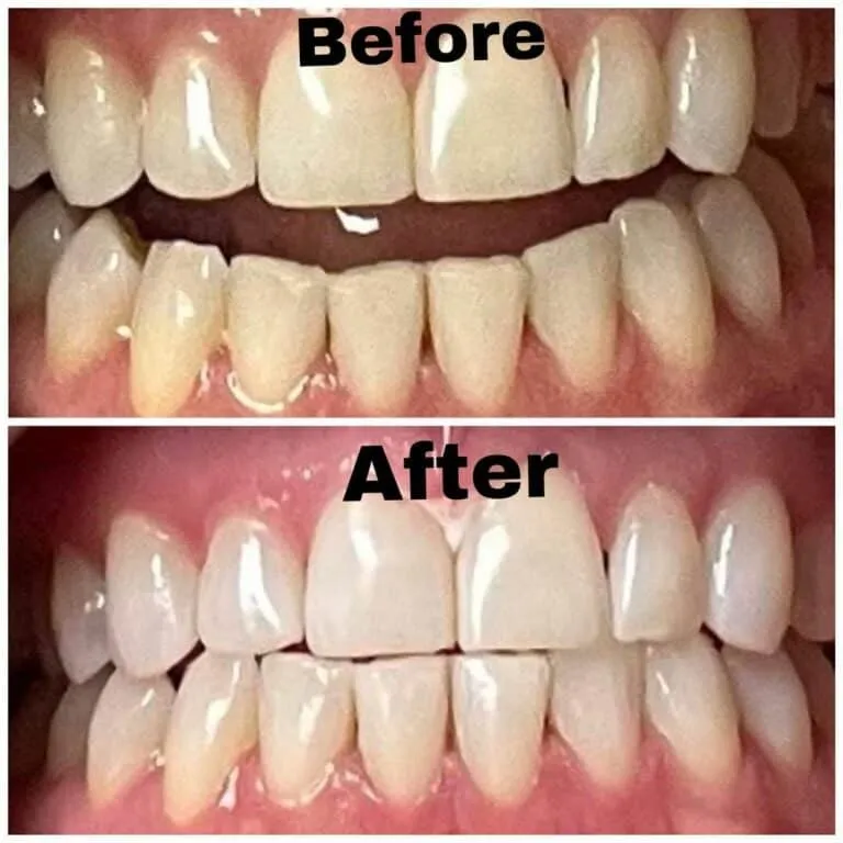 /img/26923-santa-cruz-ca-dentist-consultation.webp