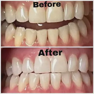 /img/26923-santa-cruz-ca-dentist-consultation.webp