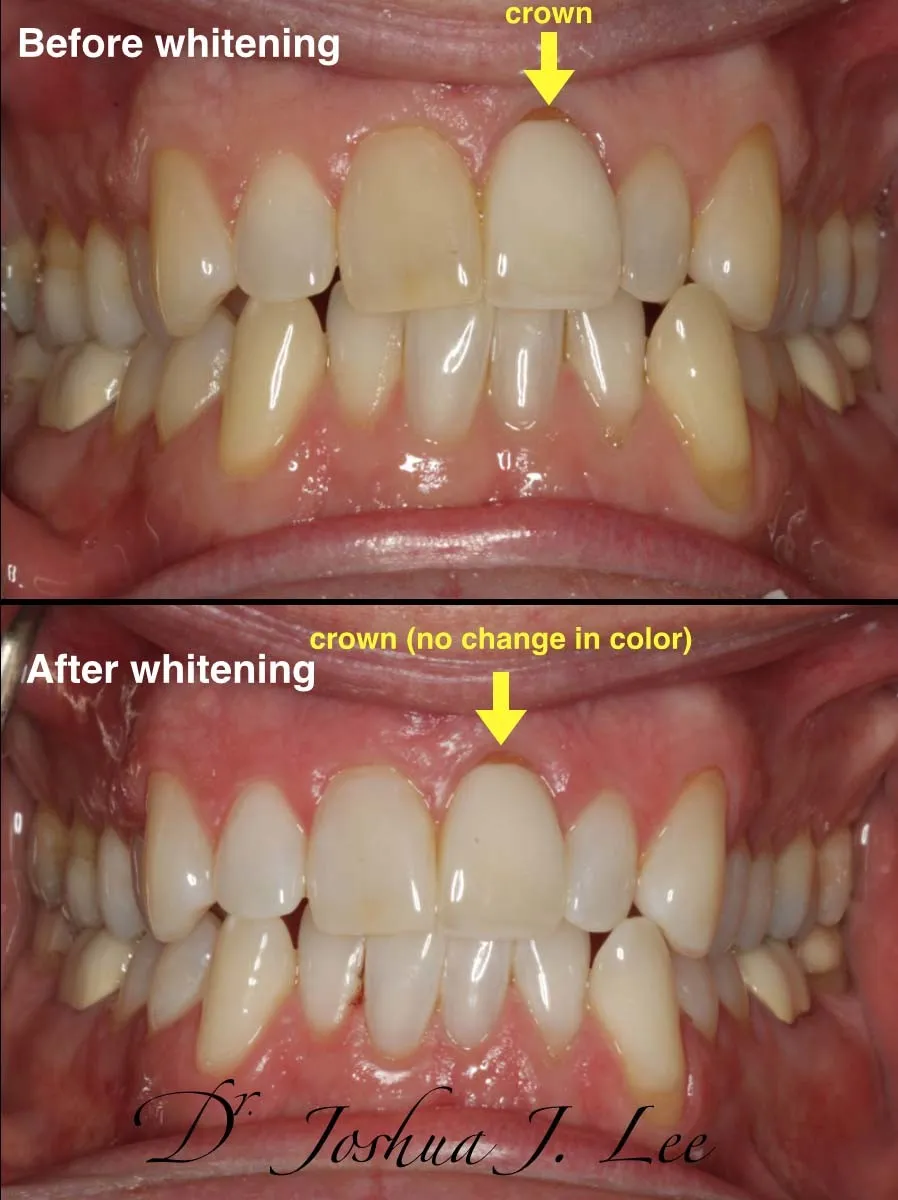 26924 zoom whitening location