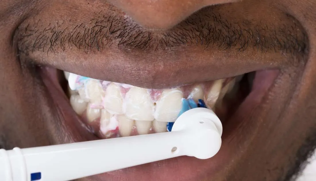 26926 teeth whitening cheam dentist