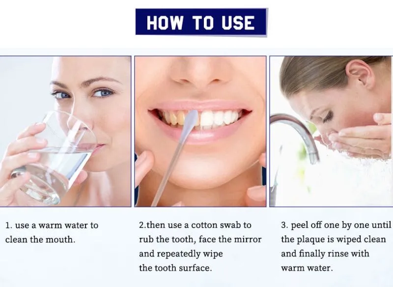 26926 teeth whitening cheam foods to avoid