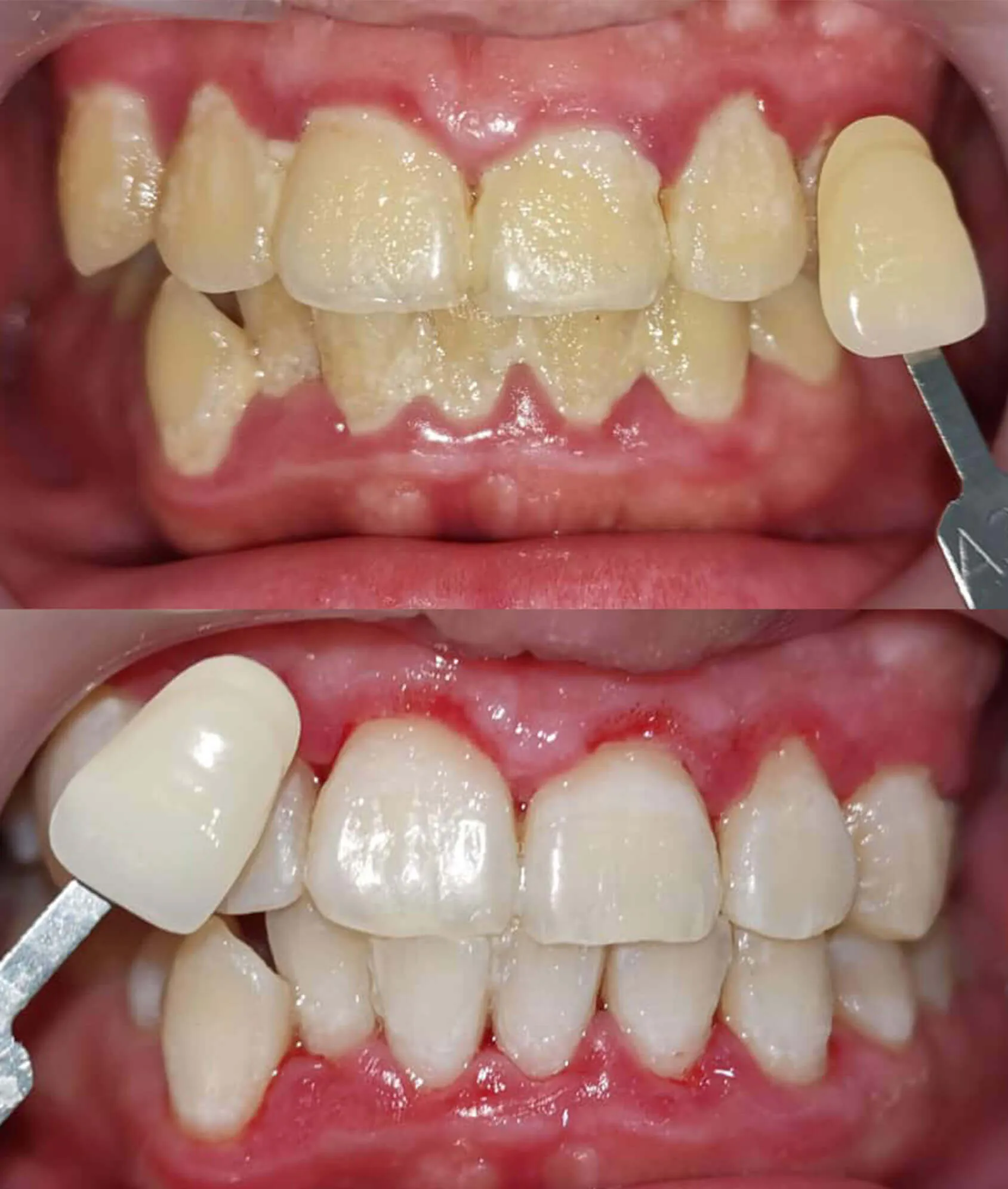 26930 whitening toothpaste