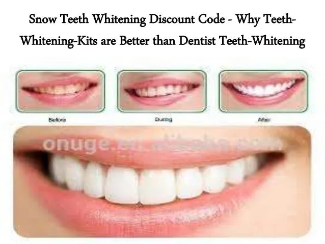 26931 snow teeth whitening promo code image4