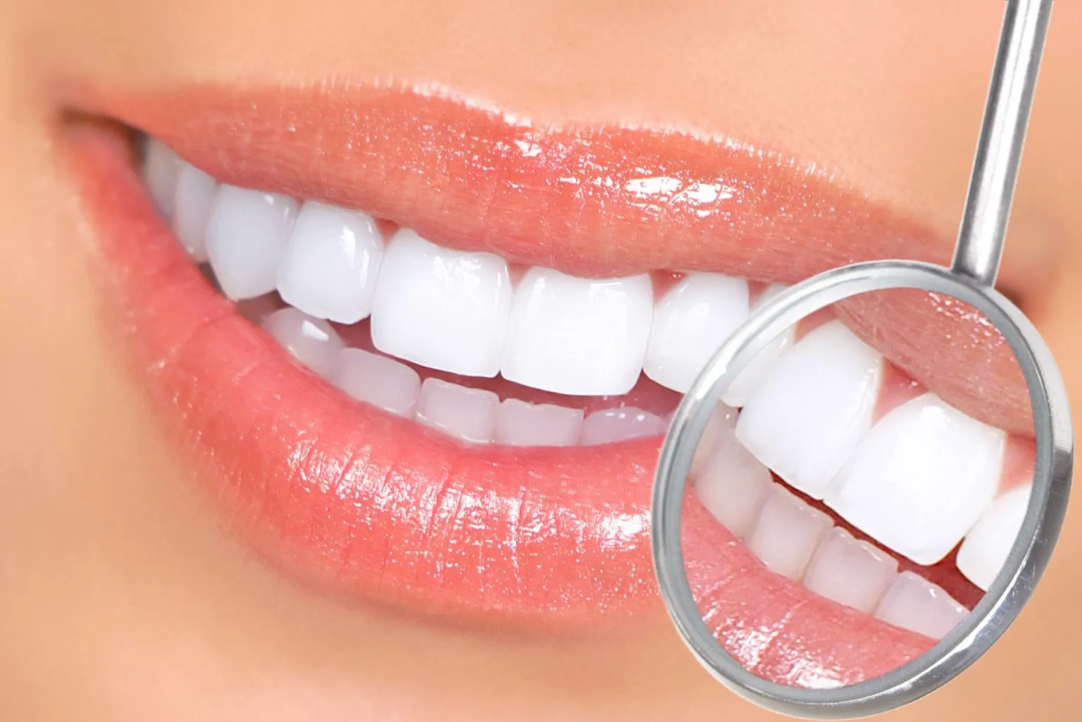 26933 tooth discoloration