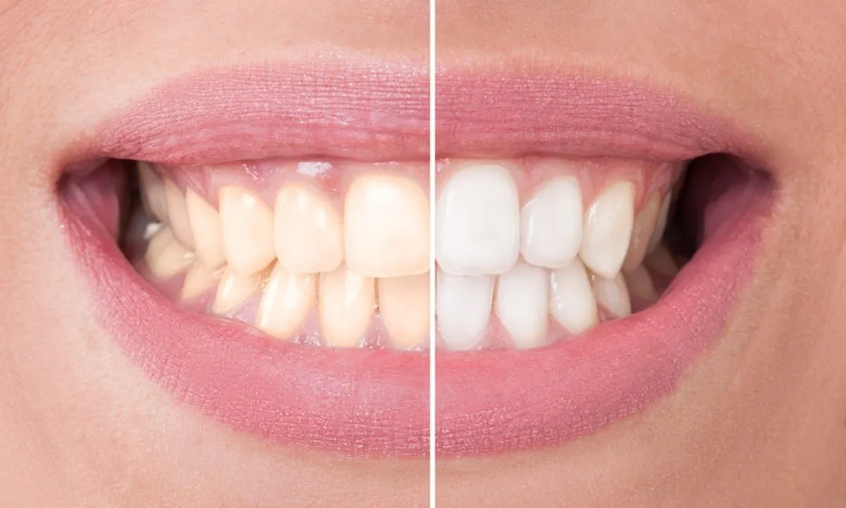 /img/26933-white-smile.webp