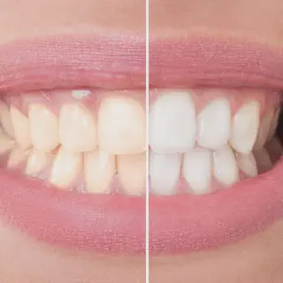 /img/26933-white-smile.webp