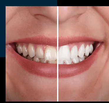 26933 whitening toothpaste