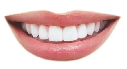 26934 teeth whitening huntington beach ca at home