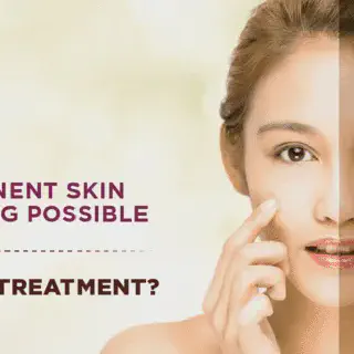 /img/26935-skin-whitening-risks.webp