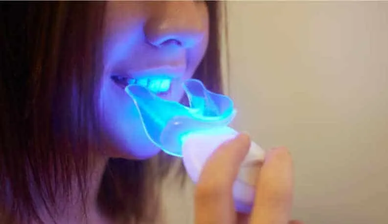 26937 teeth whitening process