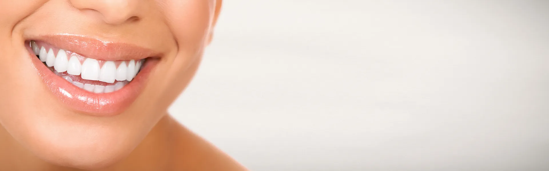 26938 teeth whitening ct image5