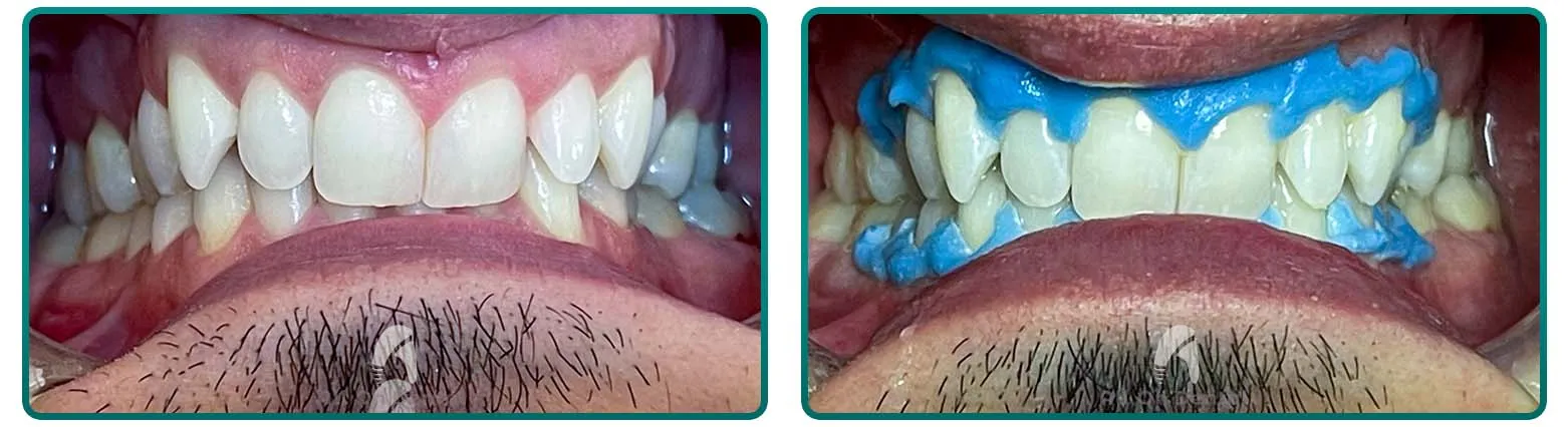 26946 good oral hygiene