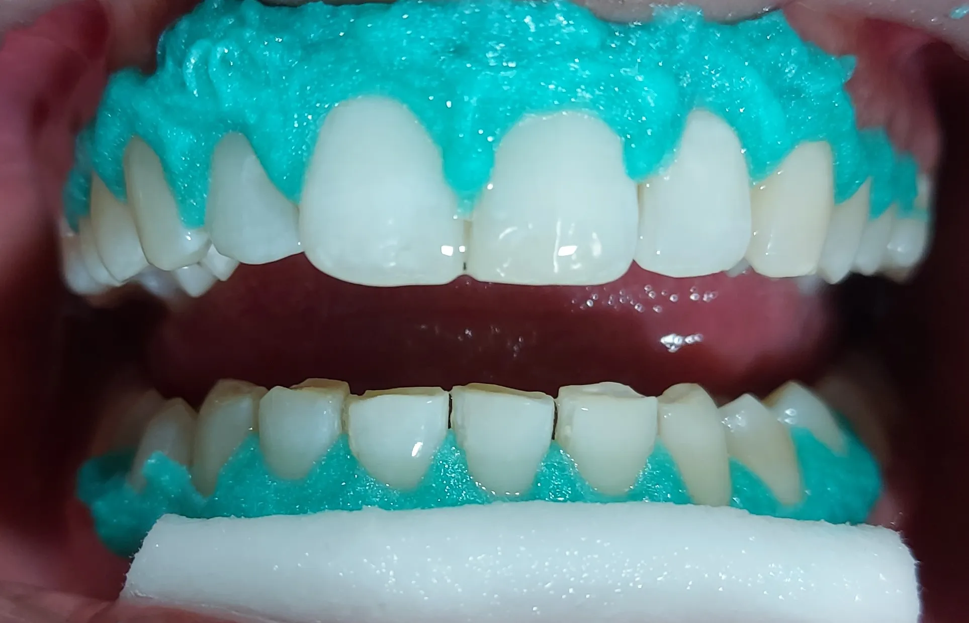 /img/26946-regular-dental-checkups.webp