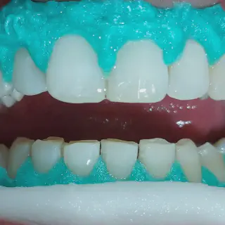 /img/26946-regular-dental-checkups.webp