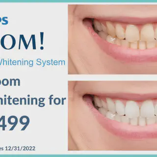 /img/26947-zoom-whitening-blotchy-teeth-8.webp