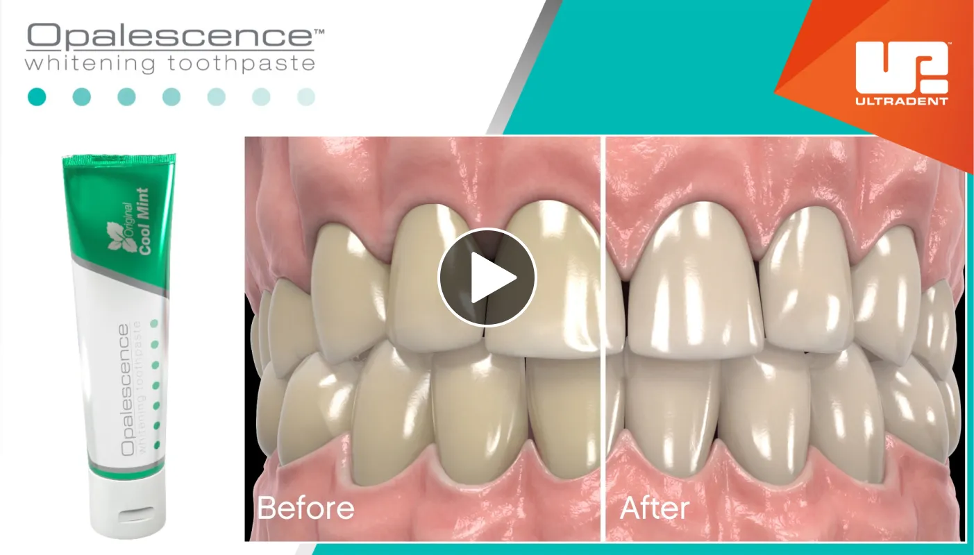 26951 teeth whitening smile