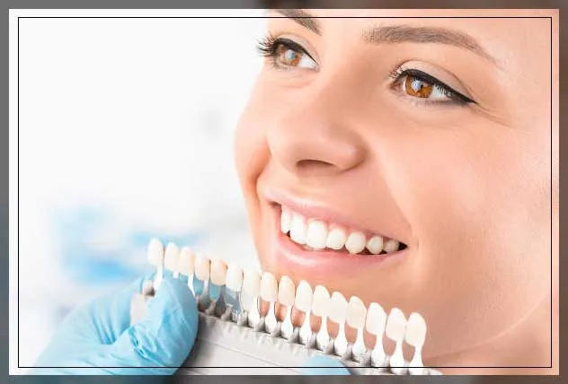 26952 in office teeth whitening