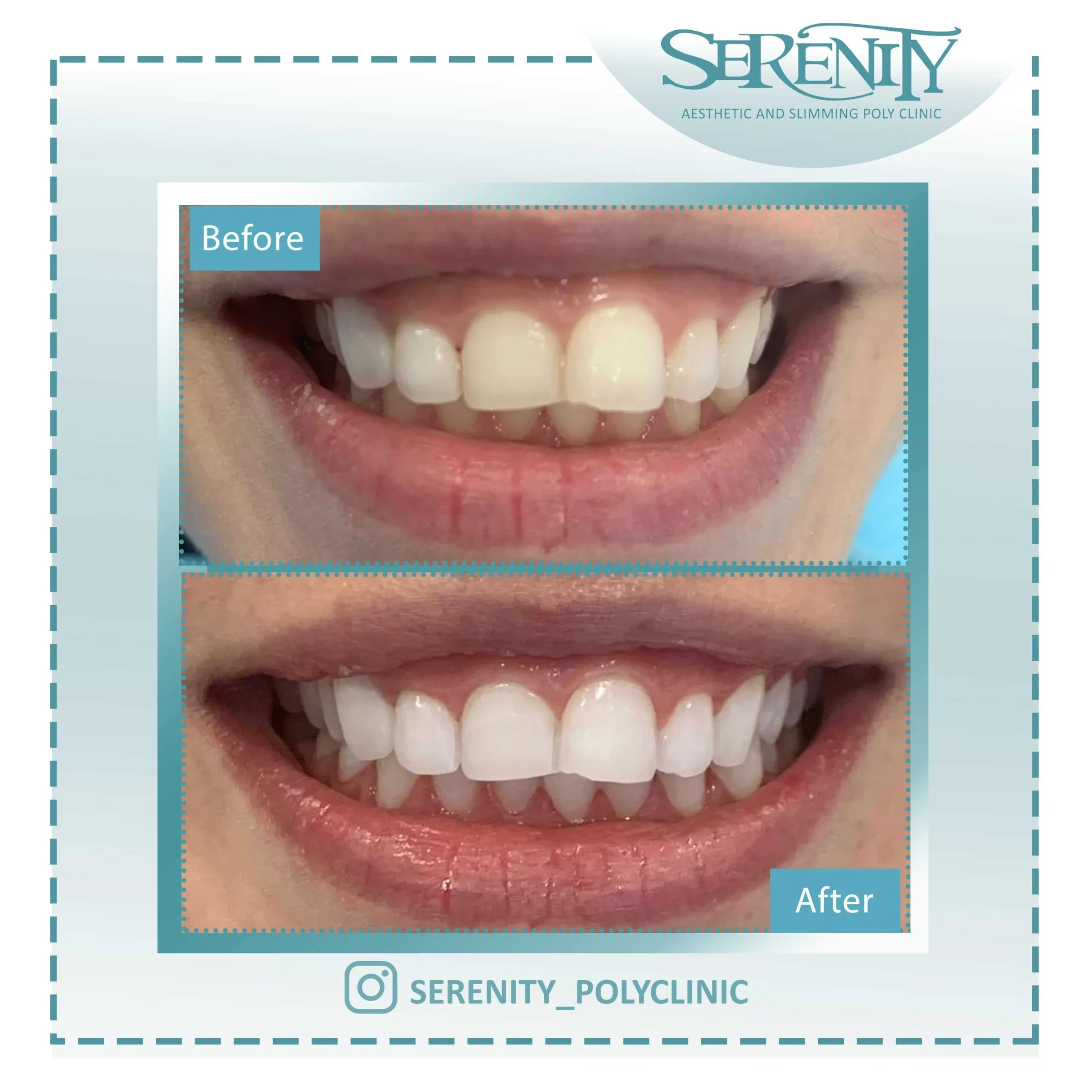 /img/26952-oral-hygiene-tips.webp