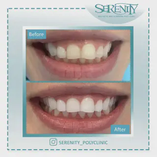 /img/26952-oral-hygiene-tips.webp