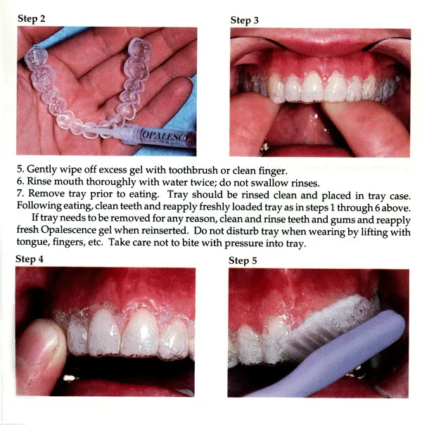 26955 tray cleaning