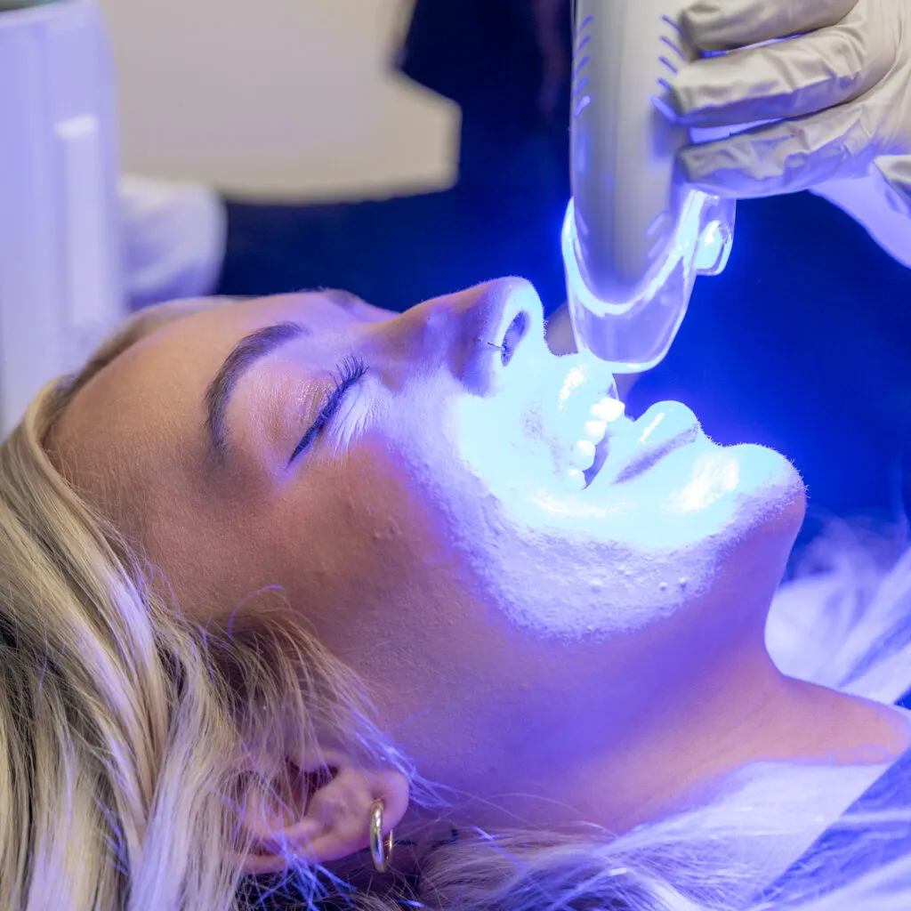 26960 teeth whitening fort collins diy kits