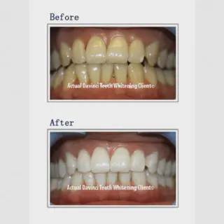 /img/26963-dr-davey-teeth-whitening-dentist.webp