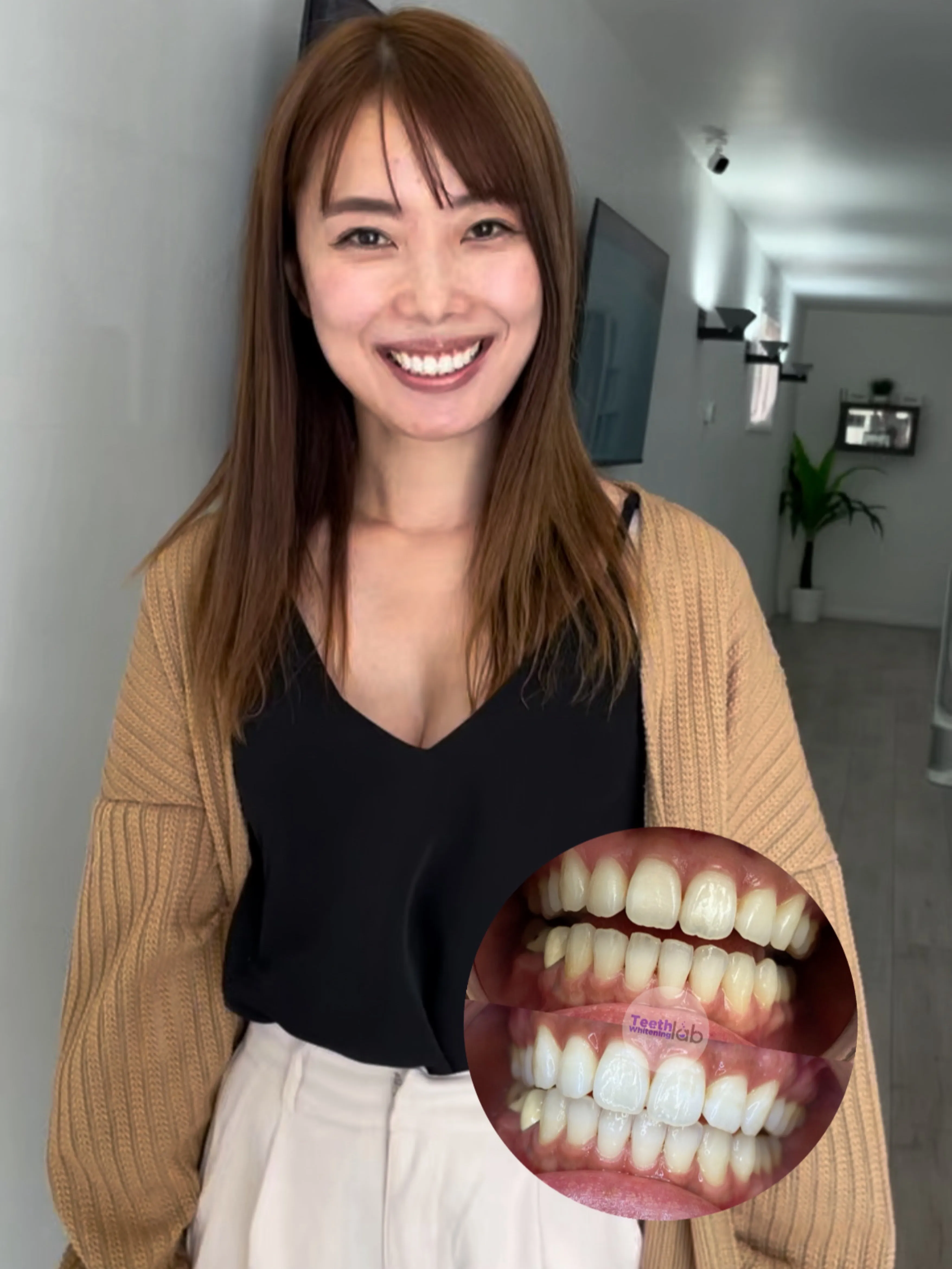 /img/26966-teeth-whitening-longview-tx-image7.webp