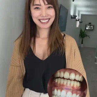 /img/26966-teeth-whitening-longview-tx-image7.webp