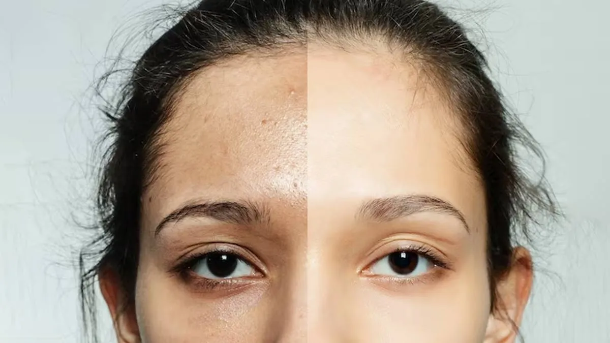 26970 coffee exfoliation