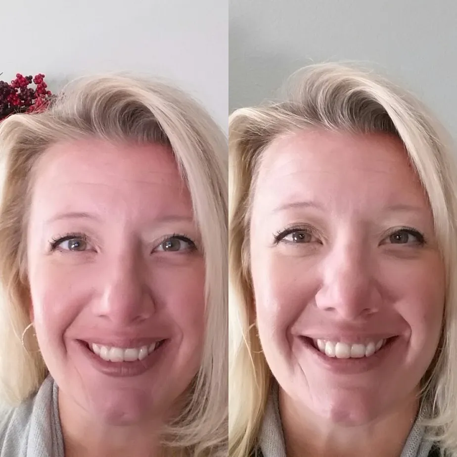26972 teeth whitening science