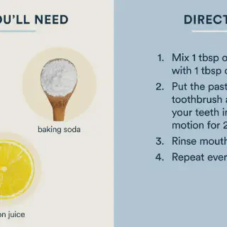/img/26976-over-the-counter-whitening.webp