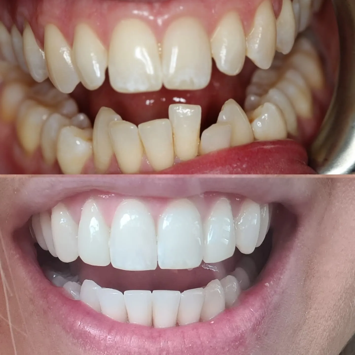 /img/26977-maintaining-white-smile.webp