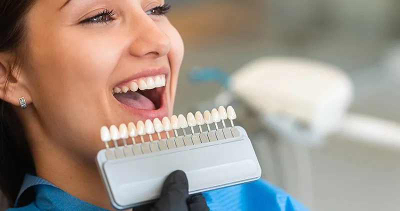 26977 teeth whitening options