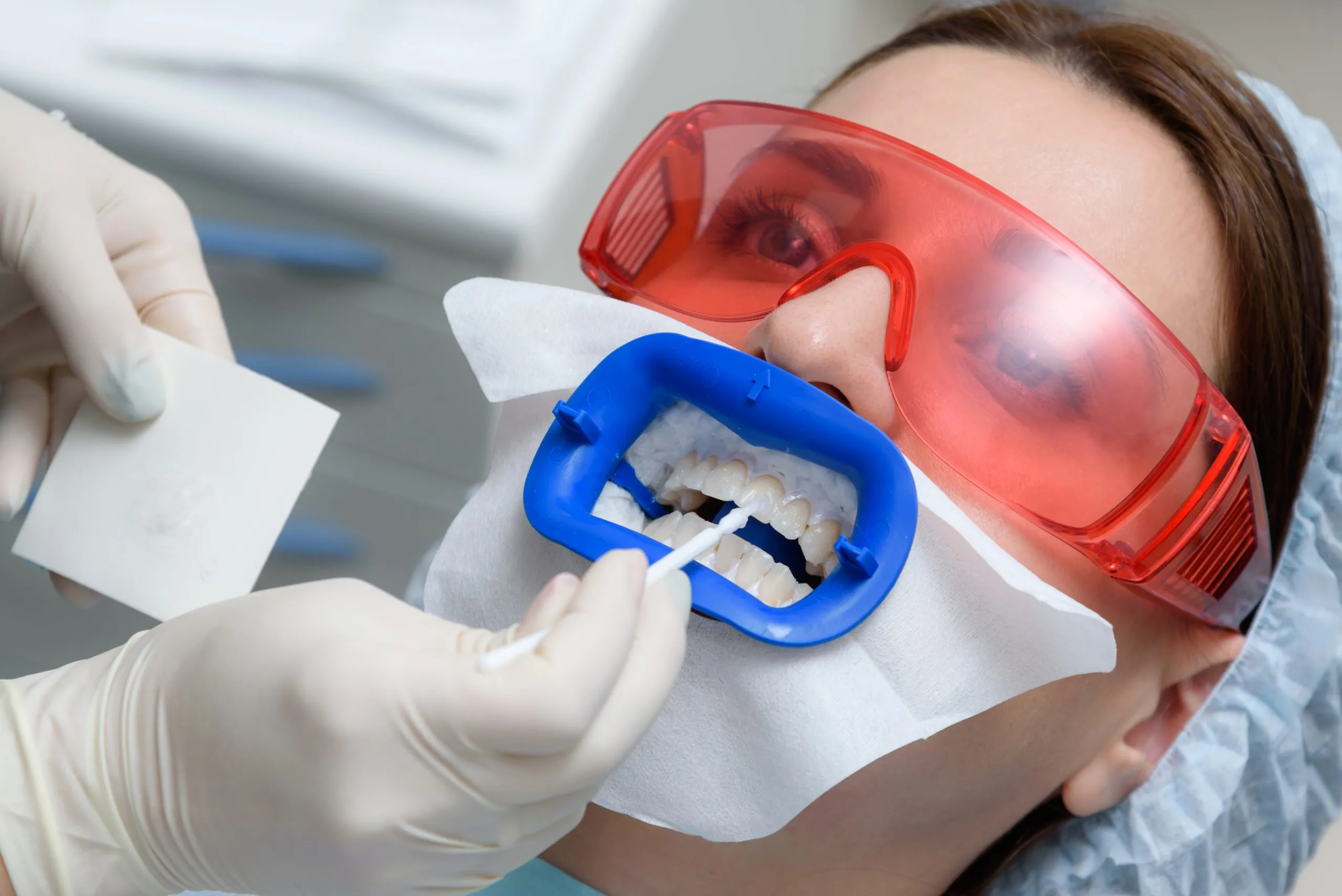 26979 types of tooth whitening