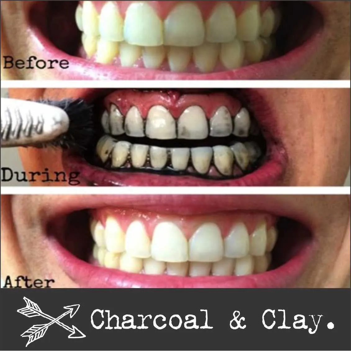 26980 charcoal vs traditional whitening