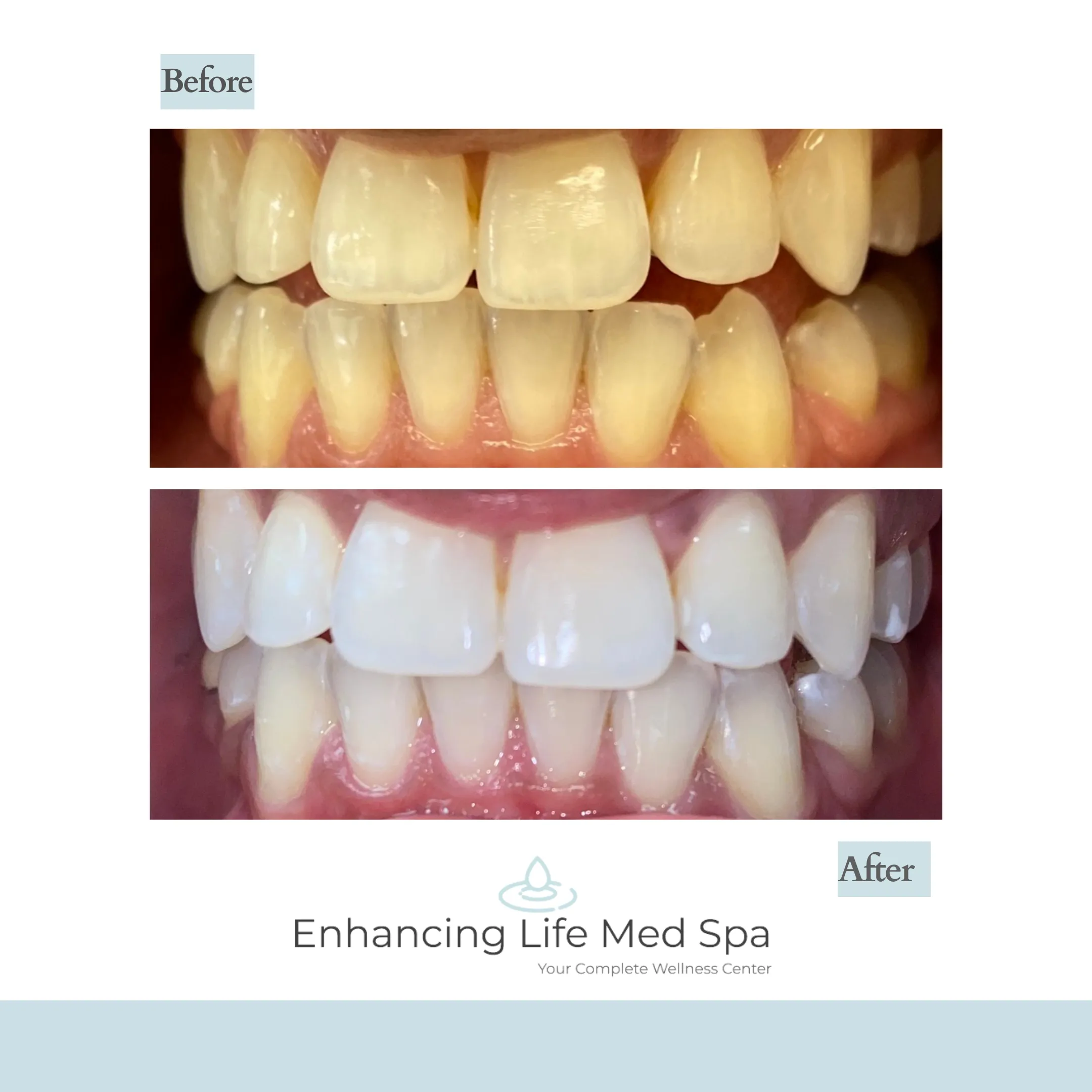 26988 teeth whitening toothpaste
