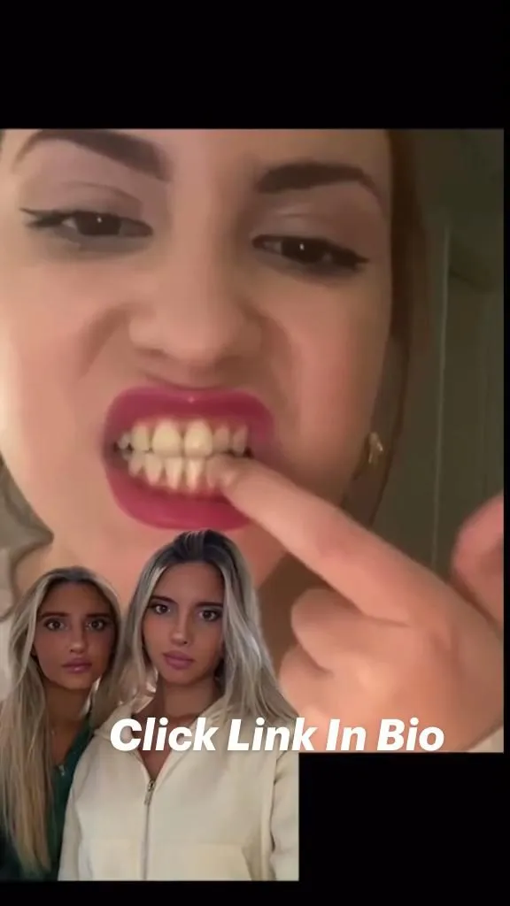 26991 flossing teeth before whitening